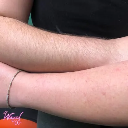 Arm hair before waxing, Orange County