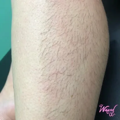Leg hair before waxing, San Juan Capistrano