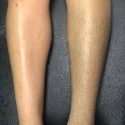 Smooth legs after waxing, San Juan Capistrano